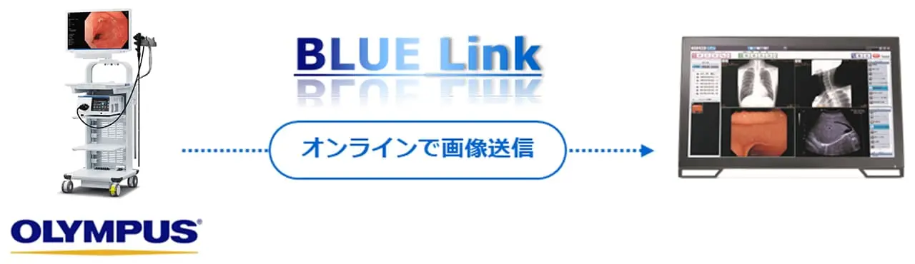 「BLUELink」接続