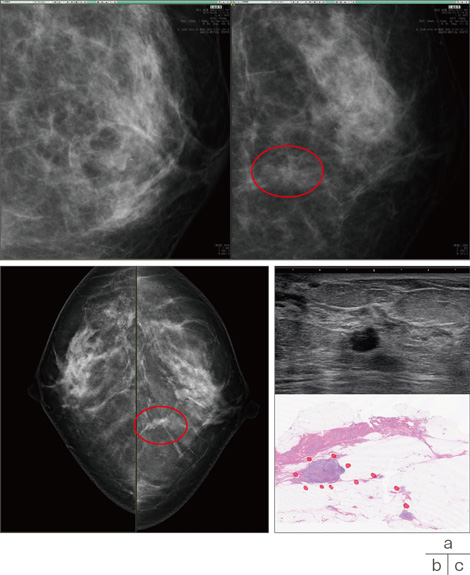 Dr.辻本の乳腺診断 2-connectedremag.com