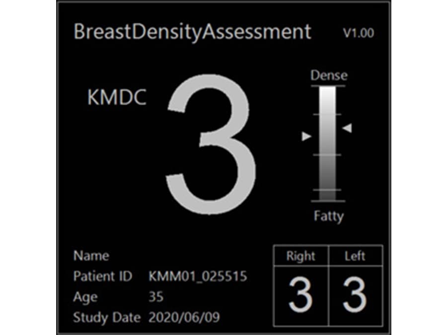 乳房構成解析ソフトウェア Breast Density Assessment (Bda)