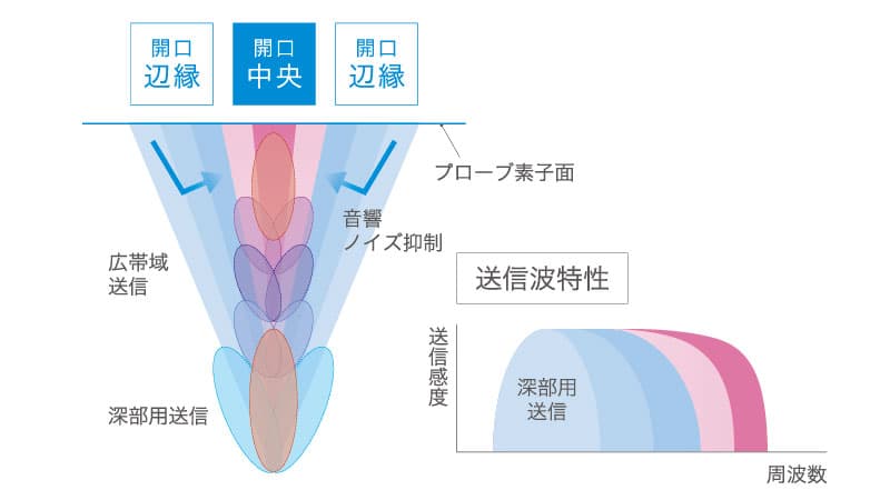 Dual Sonic® Advance