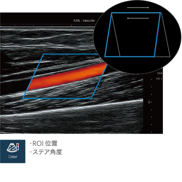 簡単操作で血液計測を瞬時にVascular NAVI®