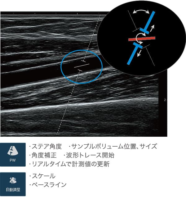 簡単操作で血液計測を瞬時にVascular NAVI®