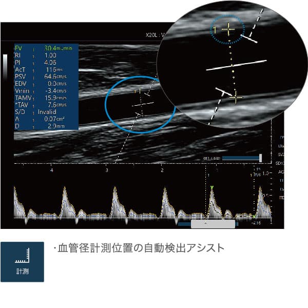 簡単操作で血液計測を瞬時にVascular NAVI®