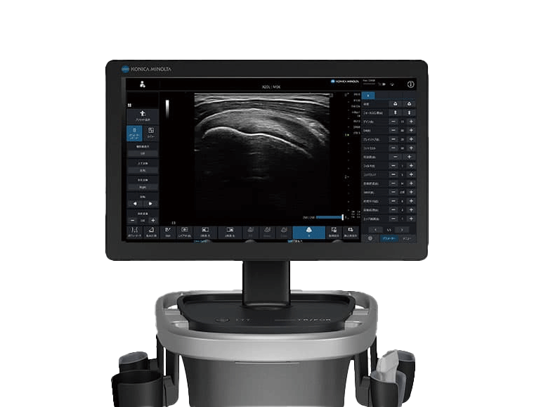 超音波診断装置 SONIMAGE UX1 TRiFOR